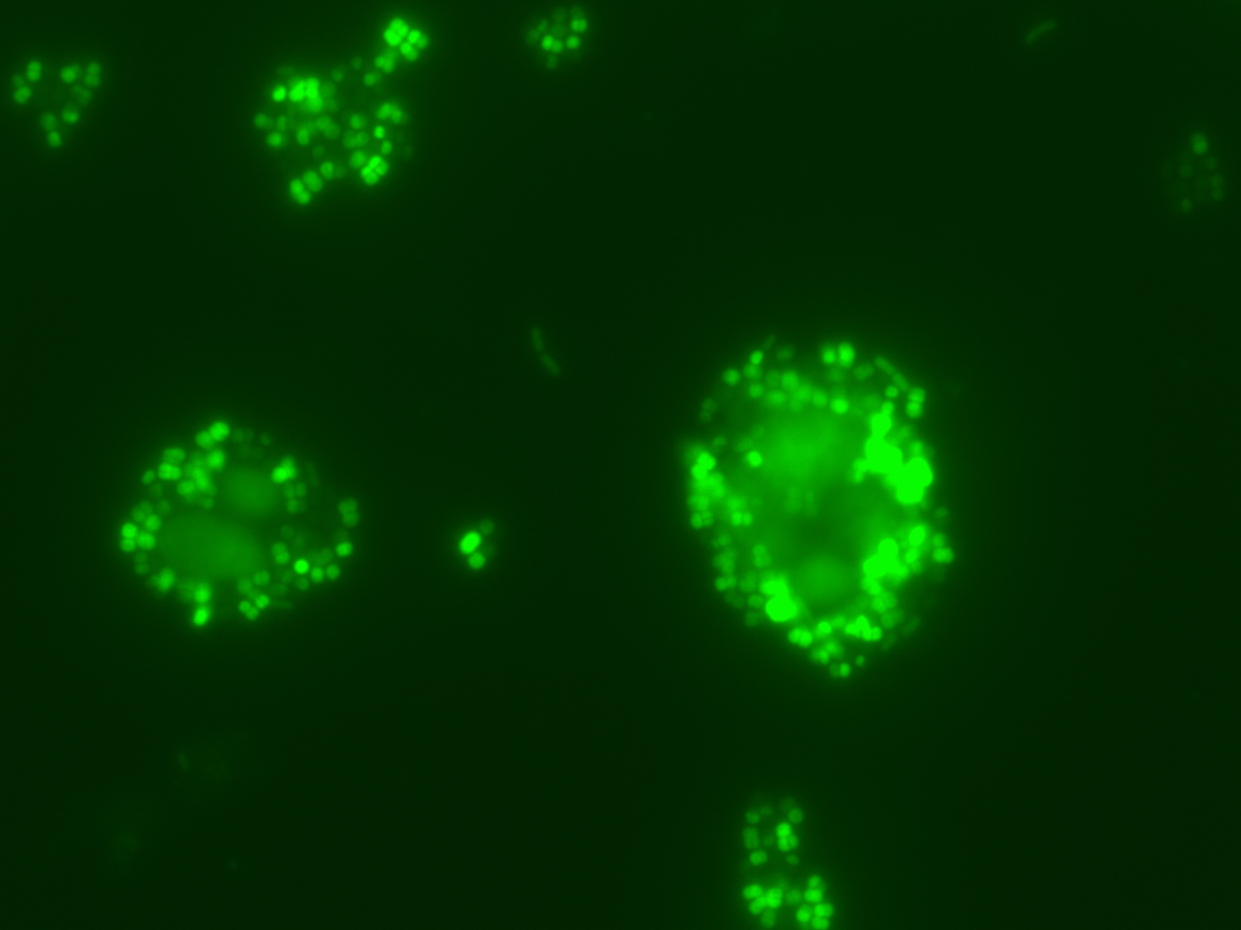grün fluoreszierende kleine runde Bakterien angelagert an große Hefezellen unter dem Mikroskop